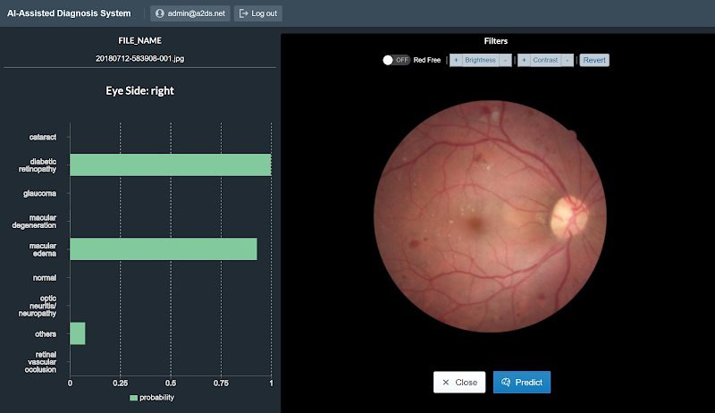 Classifyng fundus disease-Cao Thang eye hospitaI