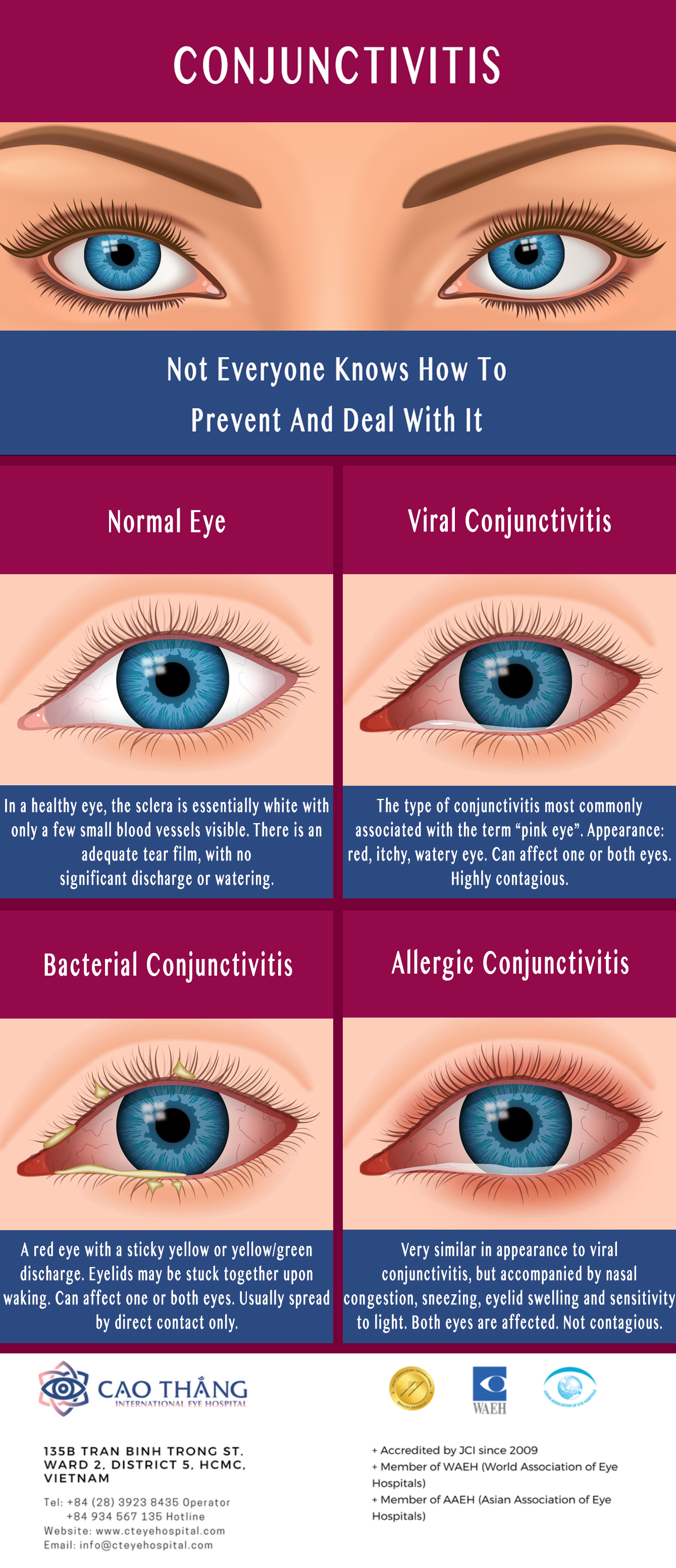 Viral Vs Bacterial Pink Eye