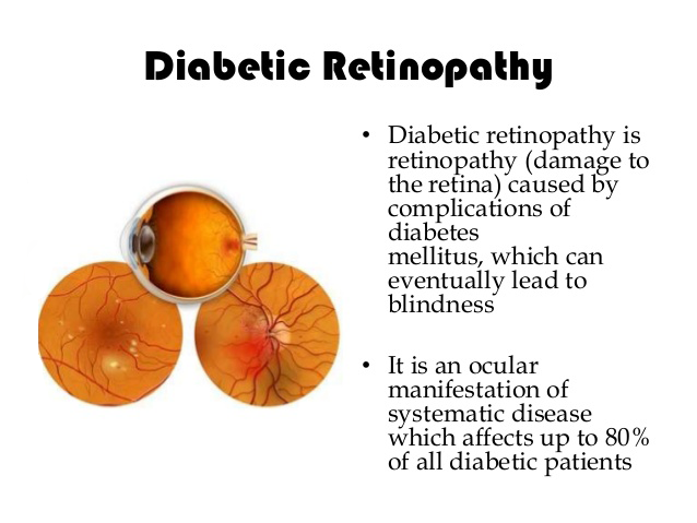 diabetic-retinopathy-cao-thang-eye-hospital01