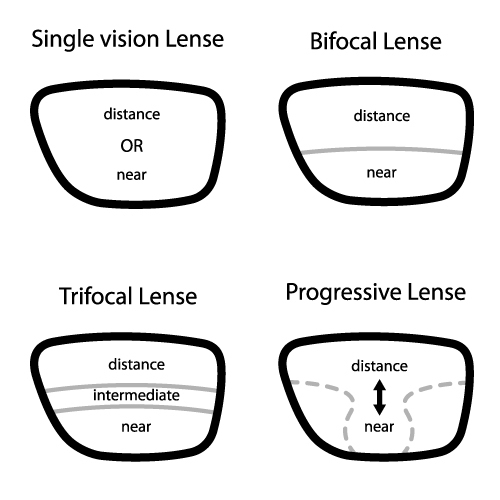 progressive lens-cao thang eye hospital