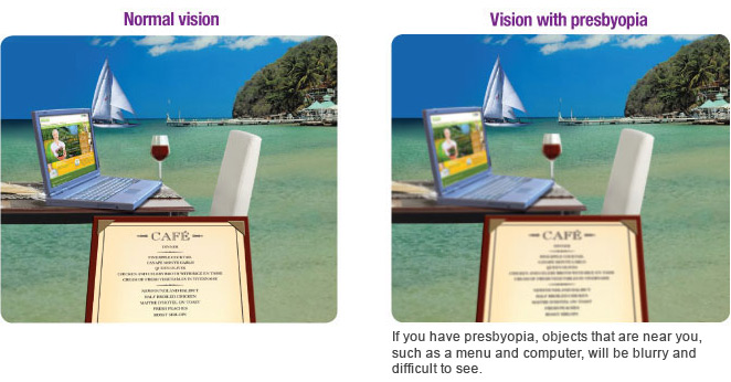 signs-of-presbyopia